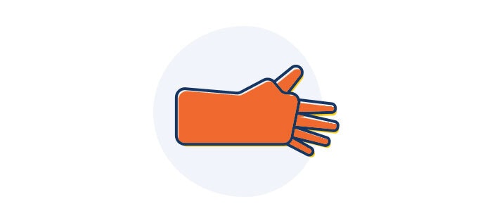 Orange hand in plaster cast